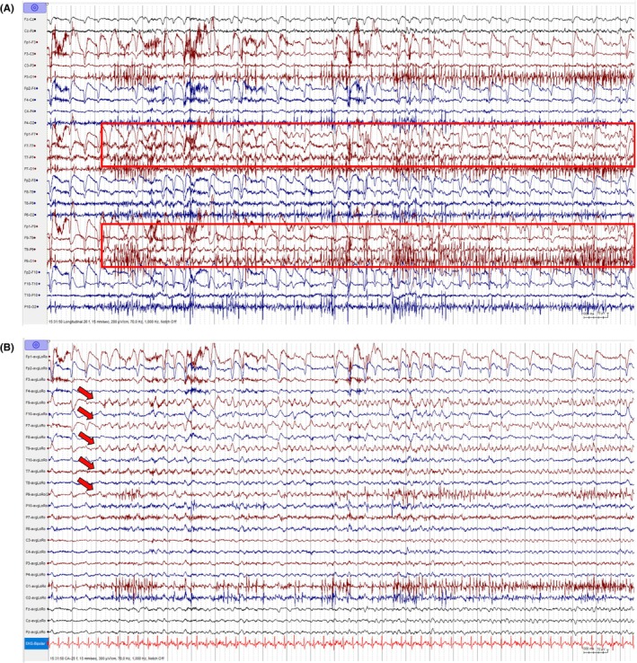 Figure 26