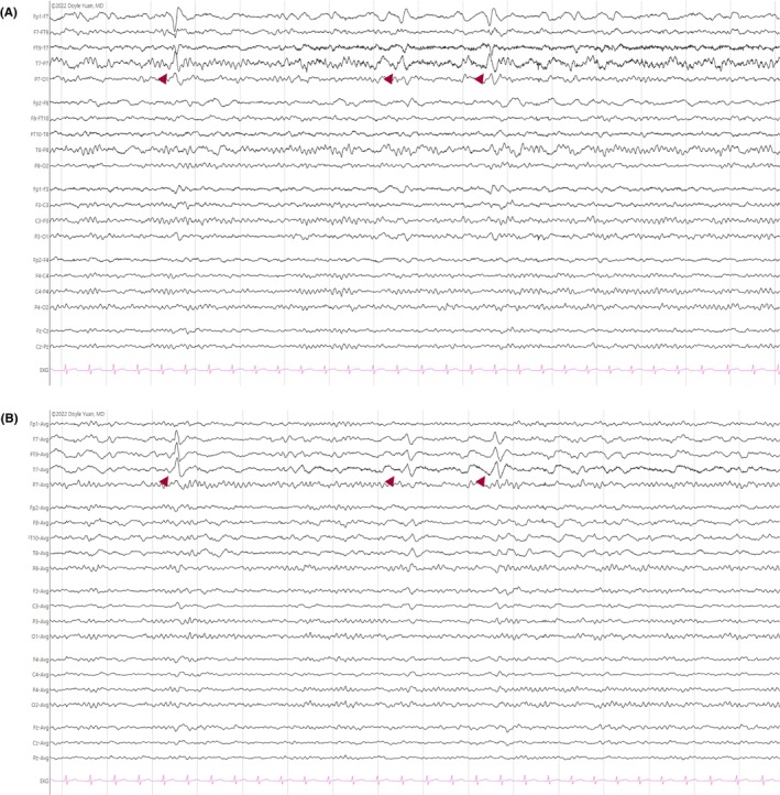 Figure 27