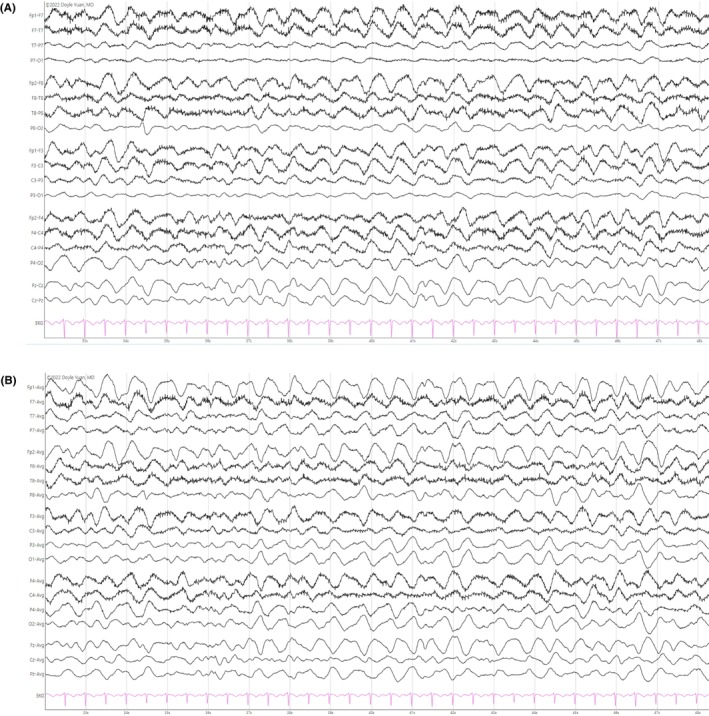 Figure 28