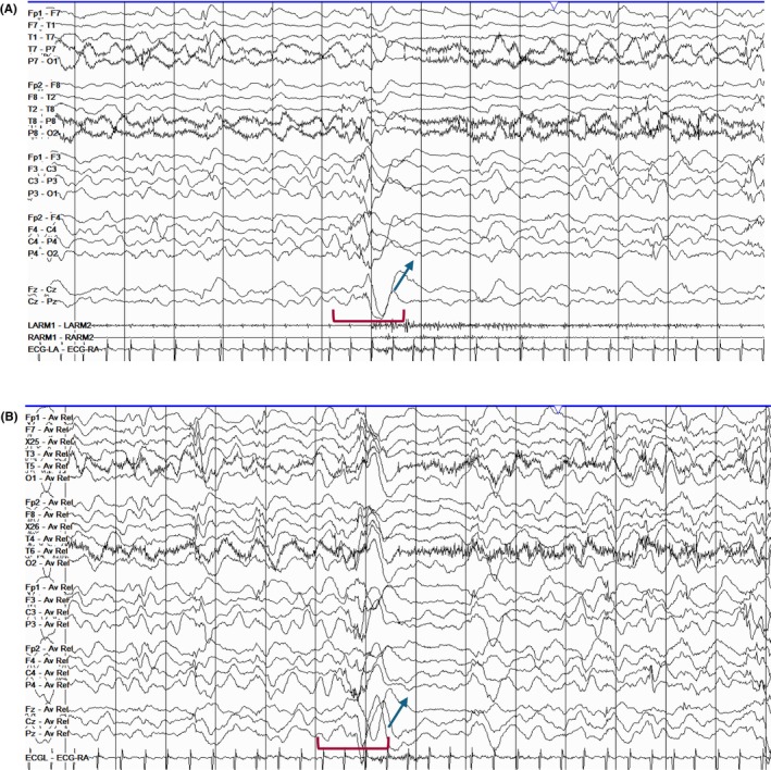Figure 29