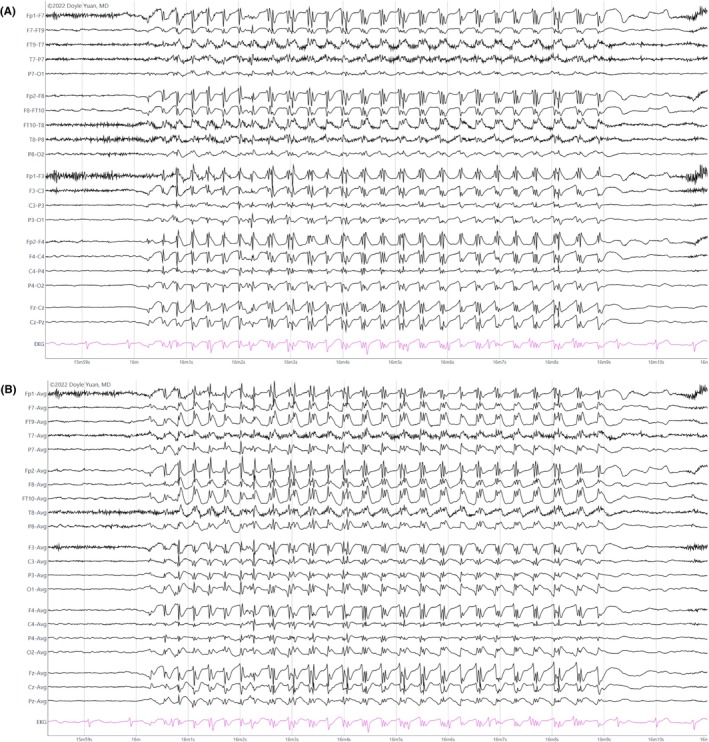 Figure 30