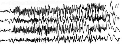 Figure 34