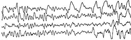 Figure 35