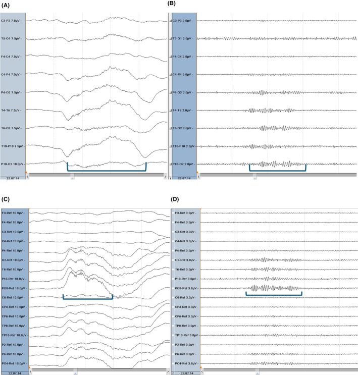 Figure 36