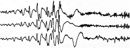 Figure 39