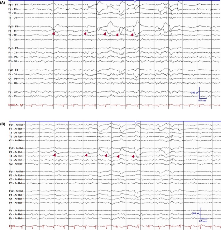 Figure 40