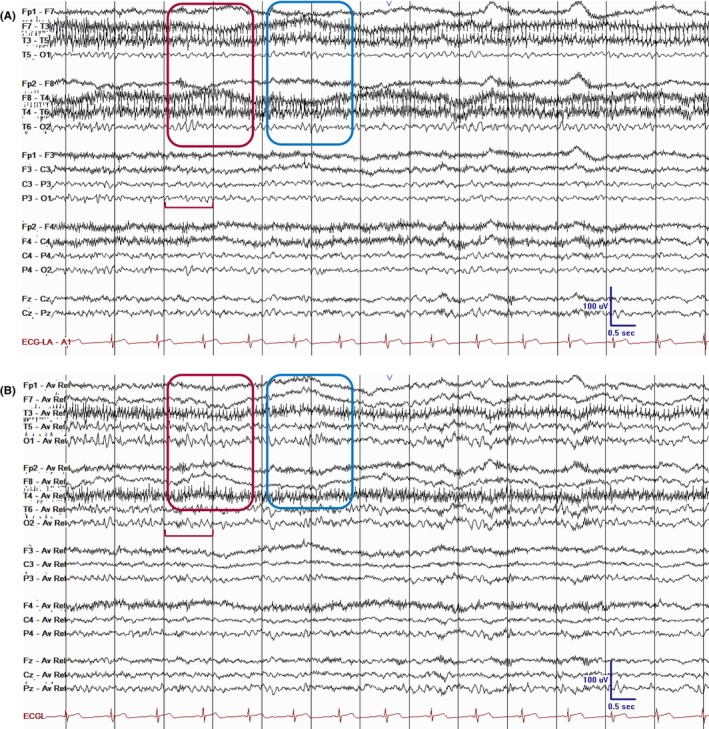 Figure 41