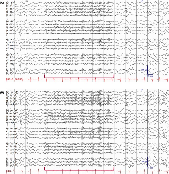 Figure 42