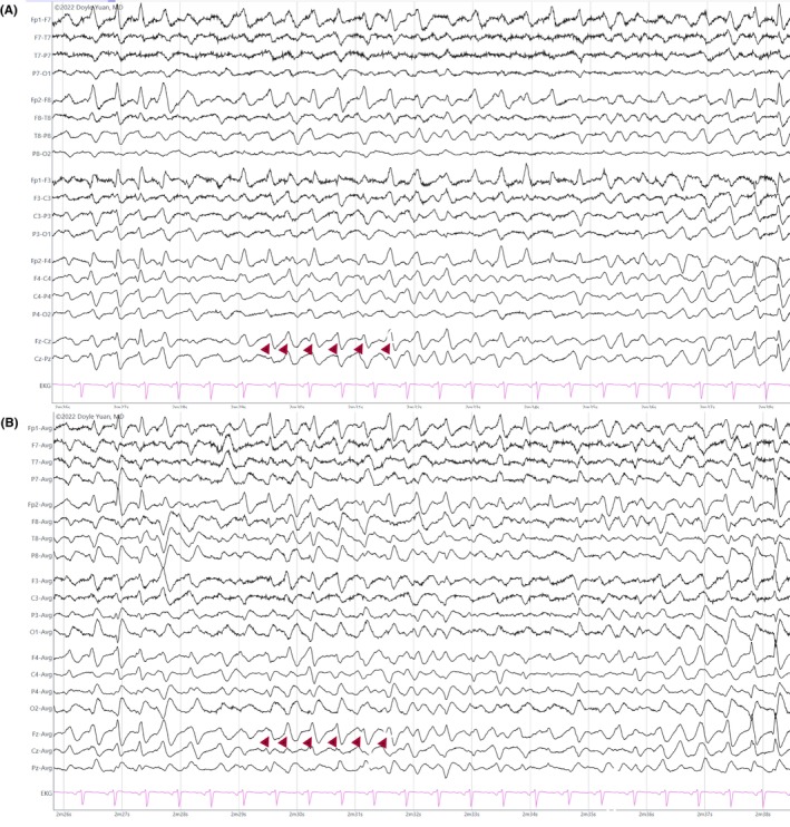 Figure 43