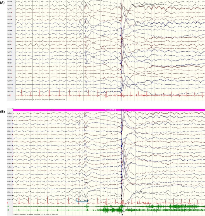 Figure 44