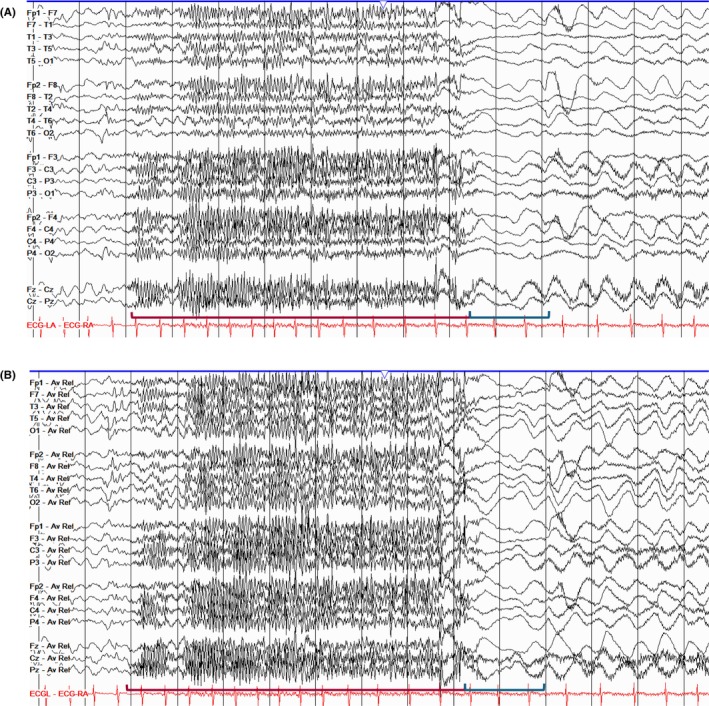 Figure 45