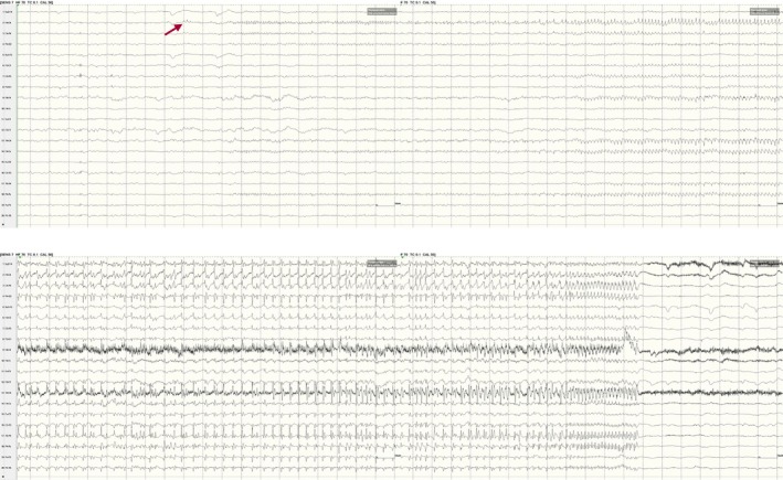 Figure 47