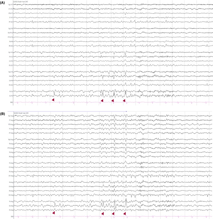 Figure 48