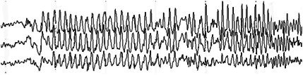 Figure 50