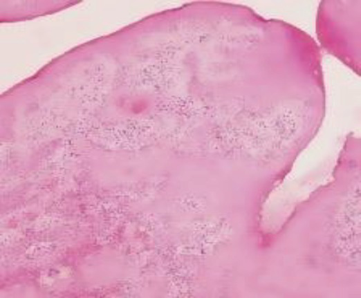 Figure 21