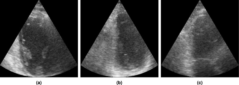 Figure 14
