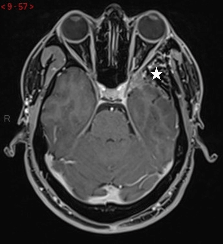 Figure 9