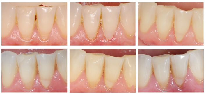 Fig 3a to f