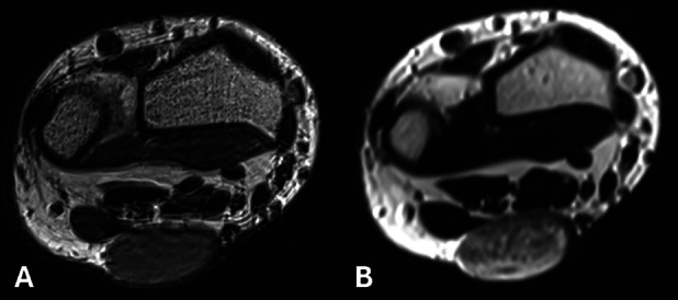 Figure 2 A–B