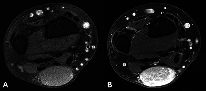 Figure 3 A–B