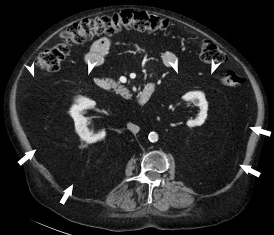 Figure 2a