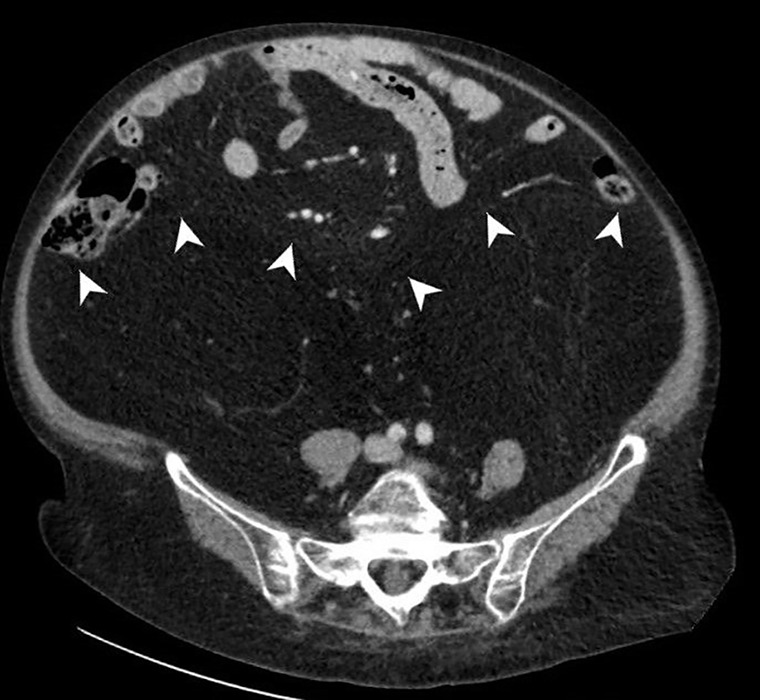 Figure 2b