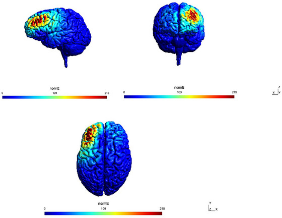 FIGURE 2