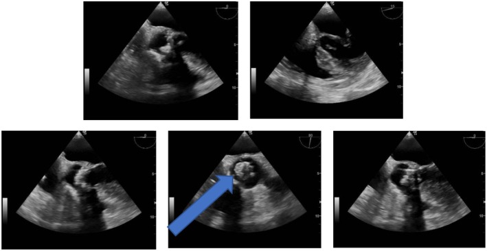 FIGURE 3