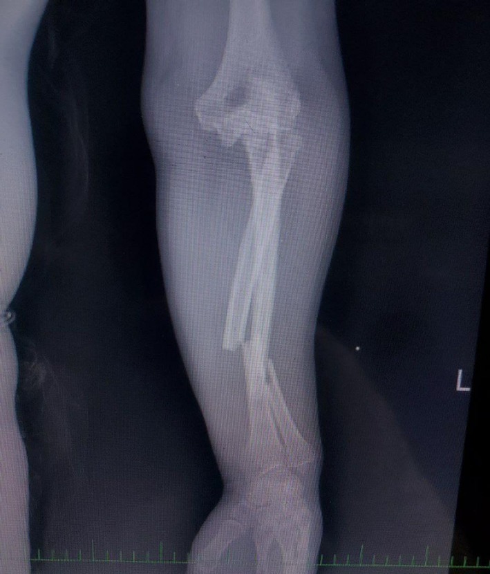 FIGURE 1