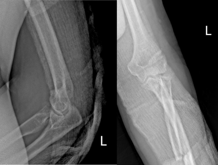 FIGURE 3