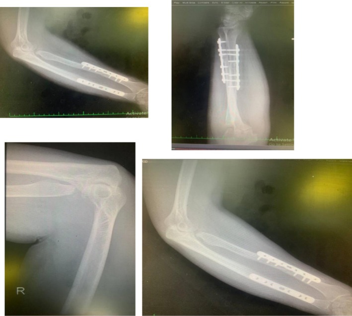 FIGURE 6