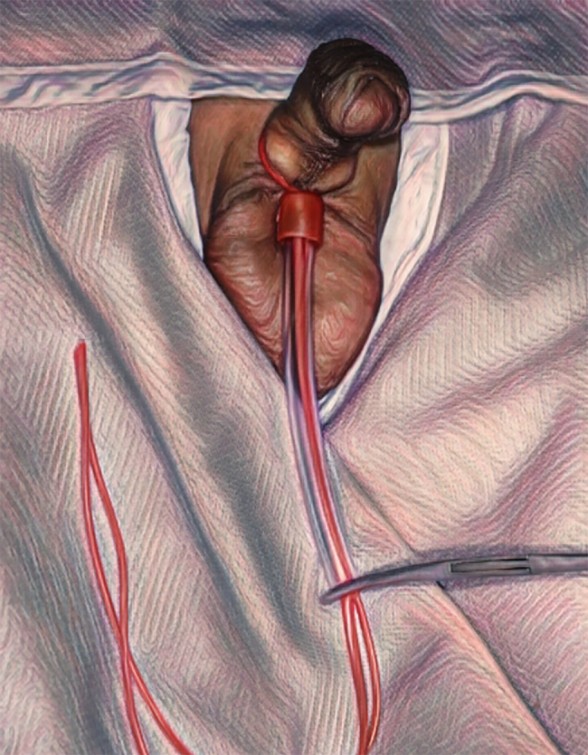 Figure 5