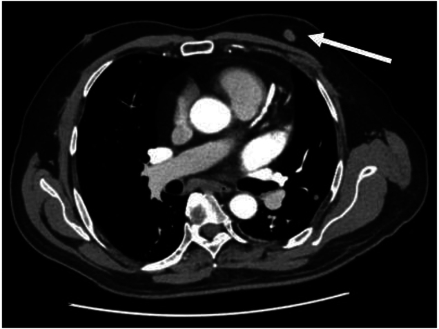Figure 1