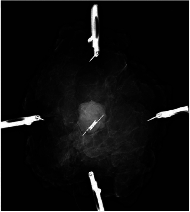 Figure 5
