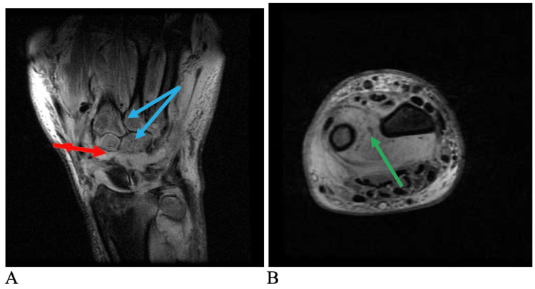 Figure 5