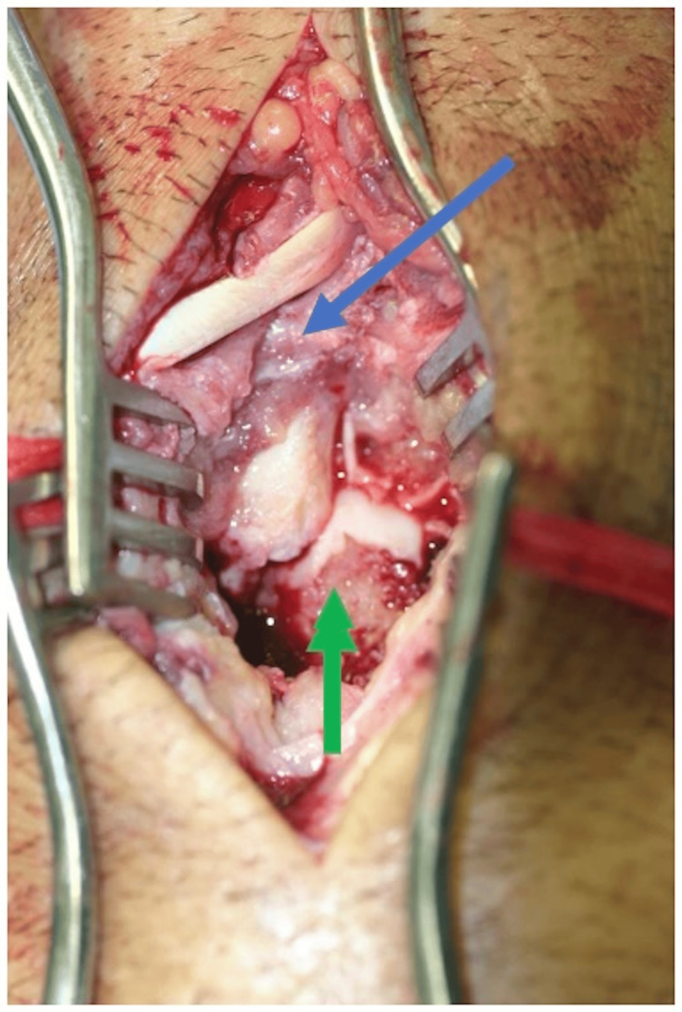 Figure 6