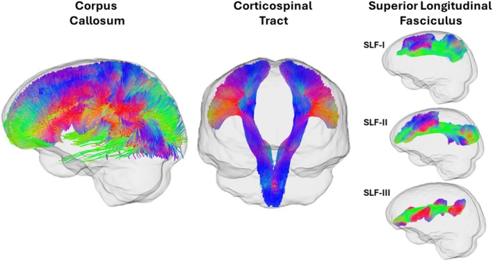 FIGURE 2