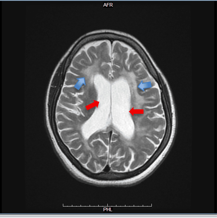 Figure 5