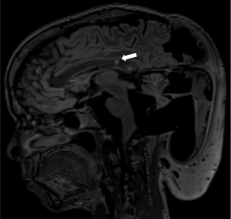 Figure 9