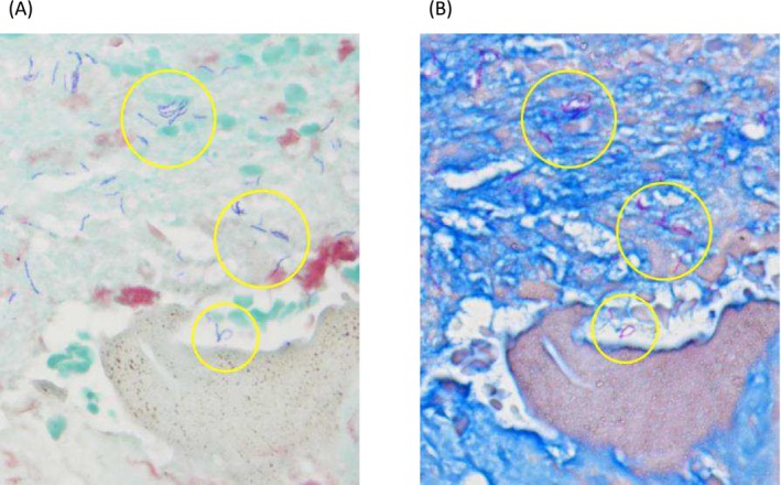 FIGURE 2