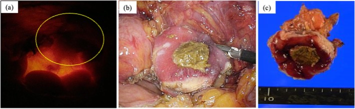 FIGURE 3