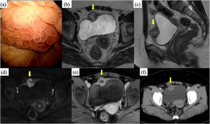 FIGURE 1