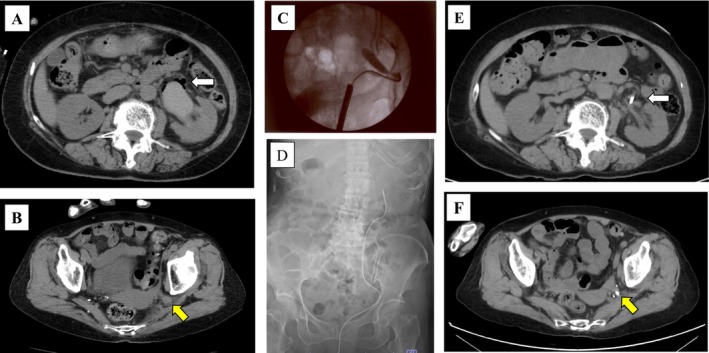 FIGURE 2