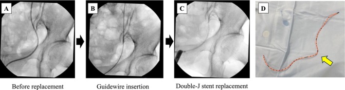 FIGURE 3