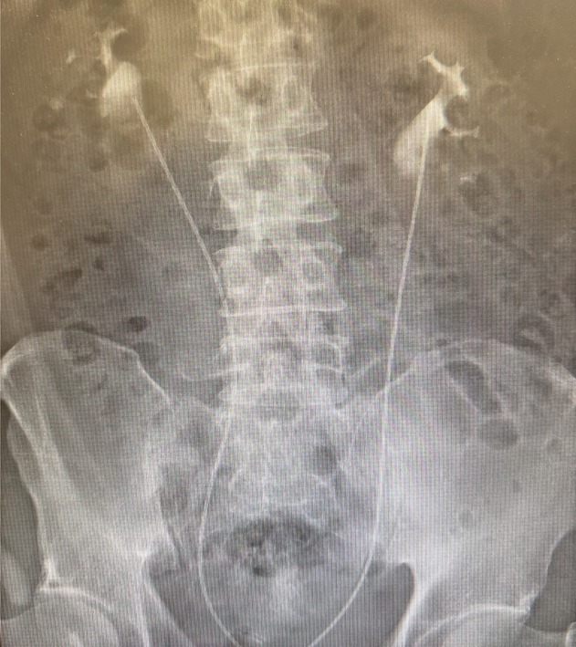 FIGURE 1