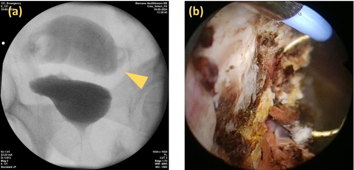 FIGURE 2