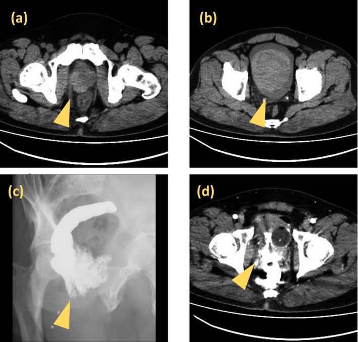 FIGURE 1