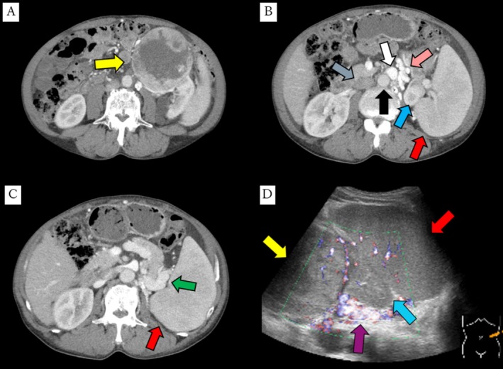 FIGURE 1