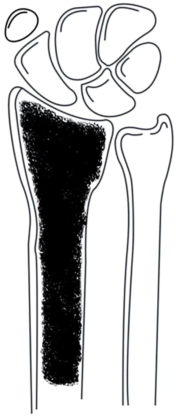 Figure 3