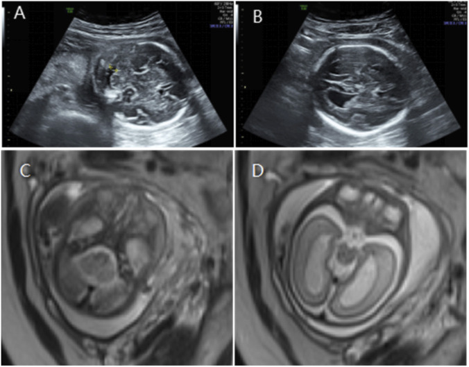FIGURE 3